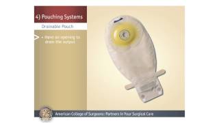 ColostomyIleostomy Pouching Systems [upl. by Sineray172]