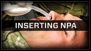 Inserting a Nasopharyngeal Airway NPA [upl. by Spain209]