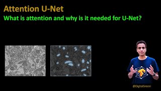 225  Attention Unet What is attention and why is it needed for UNet [upl. by Gaal935]