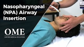 Nasopharyngeal Airway NPA Insertion [upl. by Hannover]