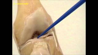 Anatomy of the knee joint [upl. by Ahsel]