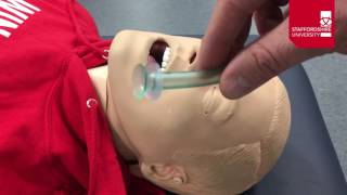 Nasopharyngeal Airway Insertion [upl. by Animsay765]