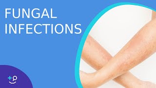 Fungal Infections  Causes Prevention and Cure [upl. by Eerac]